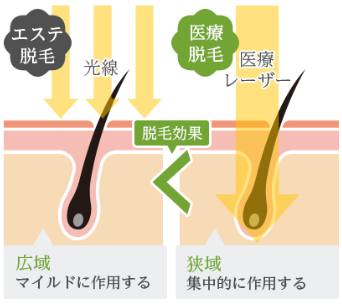 最新 無毛宣言 ライブドアブログ